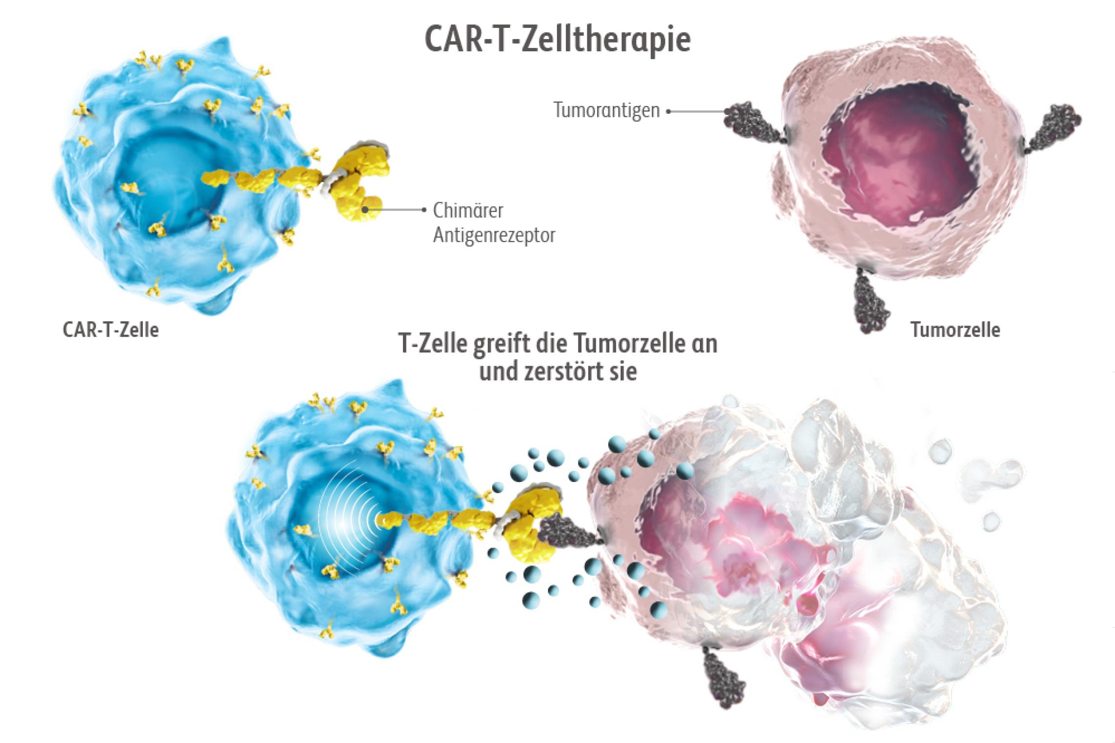 Cart Zell Therapie Multiples Myelom www.pflege-onkologie.de